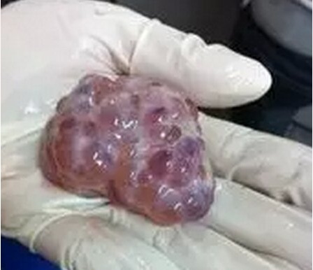研究：卵泡發(fā)育期淀粉作為主要能量來源的日糧 可提高母豬繁殖效率